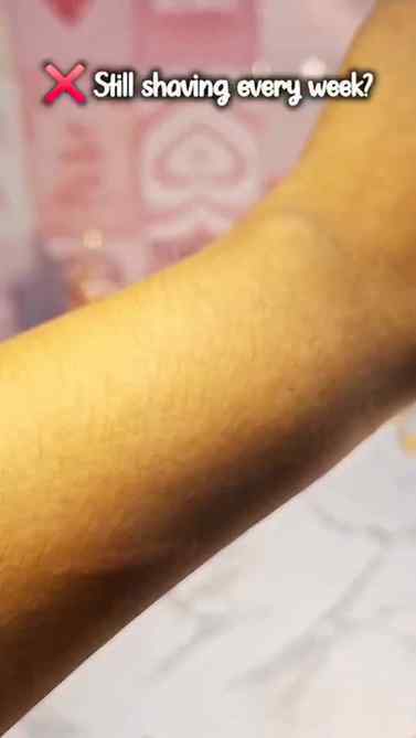 Nothing feels better than soft, smooth skin without the salo