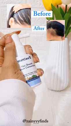 Honest Review of WishCare Hair Growth Serum
I’ve been using